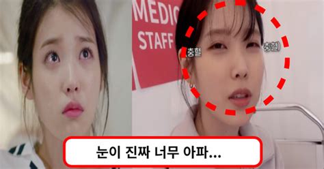 눈이 너무 아파요 아이유 영화 촬영 중 각막 손상