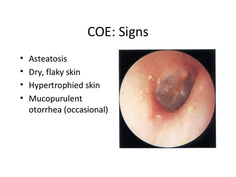 Infections of the external ear