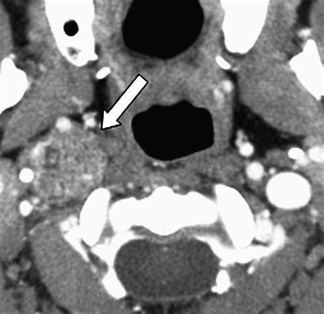 A Comparative Review Of Multidetector Ct Angiography And Mri In The