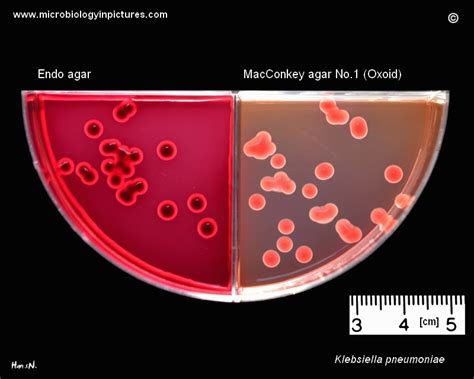 Comparison Of Klebsiella Pneumoniae Colonies Cultivated On Endo And