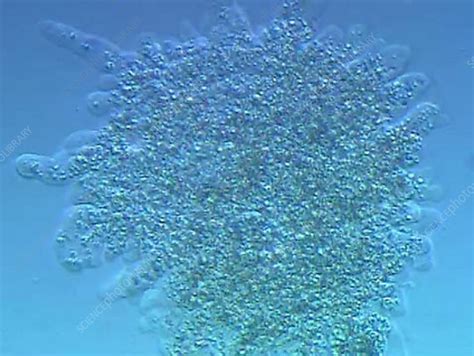 Amoeba proteus amoeba - Stock Video Clip - K002/1597 - Science Photo Library