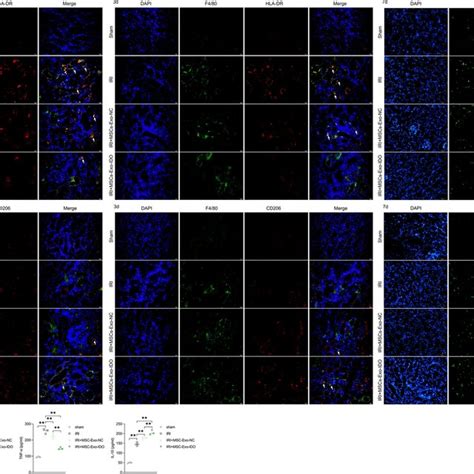 Effect Of Mscs Exo Ido On Macrophage Infiltration And Inflammation In