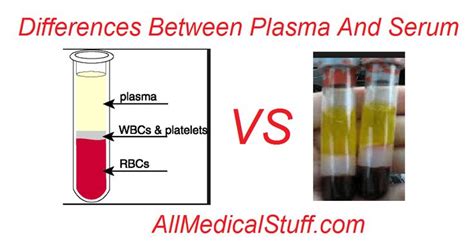 Differences Between Plasma And Serum Plasma Serum Medical