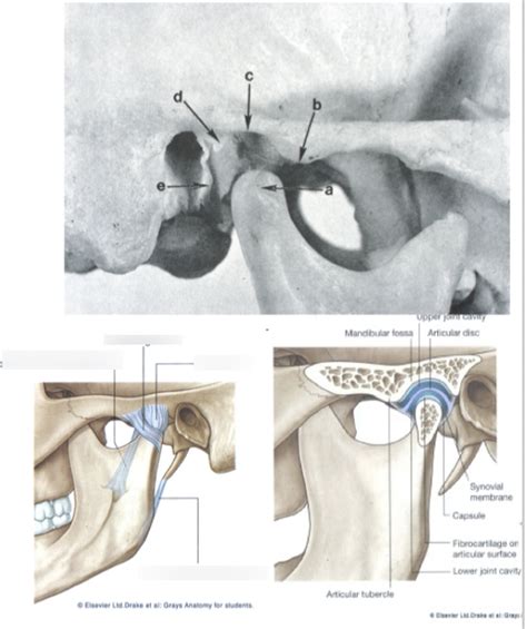 Diagram Of Temporomandibular Joint Tmj Quizlet