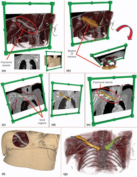 Figure 4 From Ieee Computer Graphics And Applications 79 Forensic Case