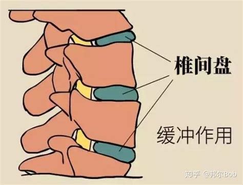 医生，我只想要句实话，腰椎间盘突出症能不能根治？！ 知乎