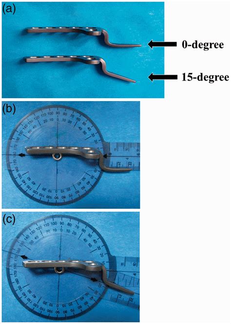 Fifteen Degree Clavicular Hook Plate Achieves Better Clinical Outcomes