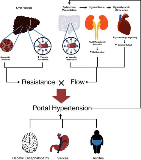 Pathophysiology Of Portal Hypertension In Cirrhosis The Increase In