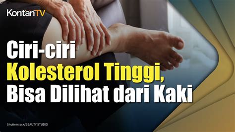 Ciri Ciri Kolesterol Tinggi Bisa Dilihat Dari Kaki Kontan News Youtube