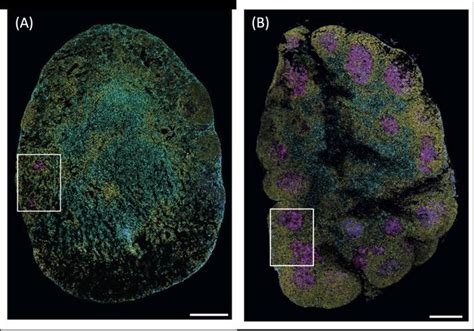 Immune Cell Discovery Could Lead To Improved EurekAlert