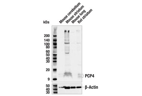 Pcp4 Antibody Cell Signaling Technology