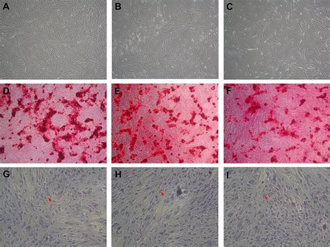 The Proliferation Capacities Of Fbs Milk And Whey Treated