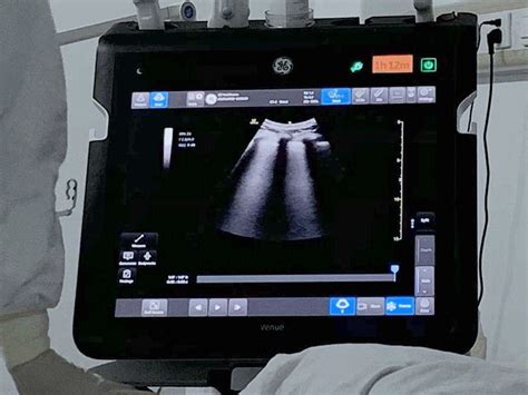 A Ray Of Light Ai Enhanced Ultrasound Is Helping On The Front Line