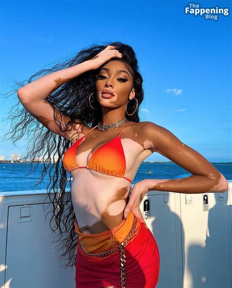 Winnie Harlow Winnieharlow Nude Leaks Photo 1091 Thefappening