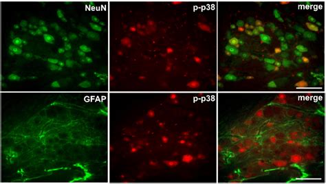 Double Immunostaining For P P With Neun A Marker Of Neuron And Gfap