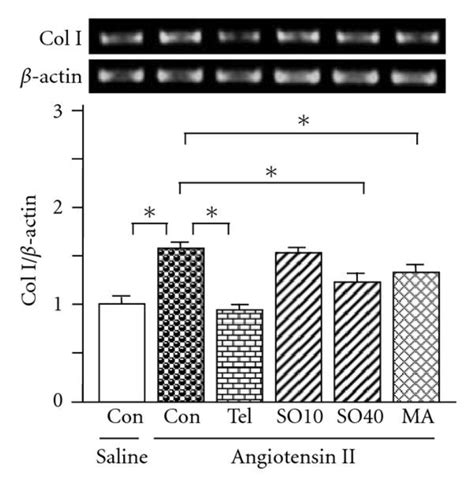 Expression Of Collagen Col I A Col Iv B Fibronectin C Mrnas