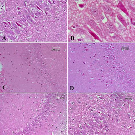 Representative photomicrographs of sections from the hippocampus. a and ... 