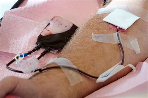 Fda Drops Blood Donation Restrictions Specific To Gay And Bisexual Men Abc News