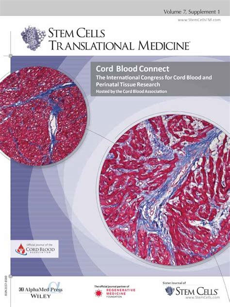 Comparison Of Ex Utero And In Utero Cord Blood Collection Methods