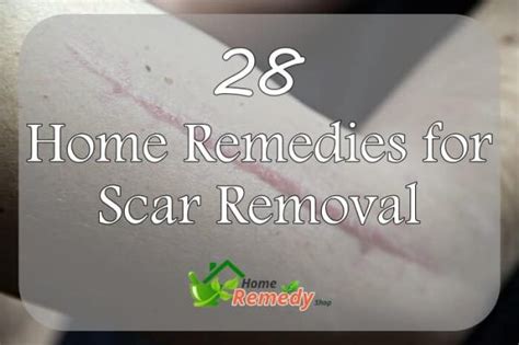 28 Home Remedies For Scar Removal Home Remedies