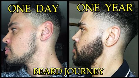 Rogaine Beard Before And After Pictures