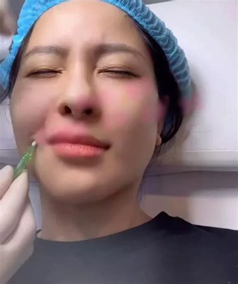 Hot girl Trâm Anh khoe cận cảnh tiêm mặt nhìn mà hãi Báo Tri thức và Cuộc sống TIN TỨC PHỔ