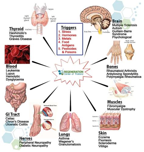 UC-MSC+ Stem Cell Treatment for Autoimmune Diseases in 2024