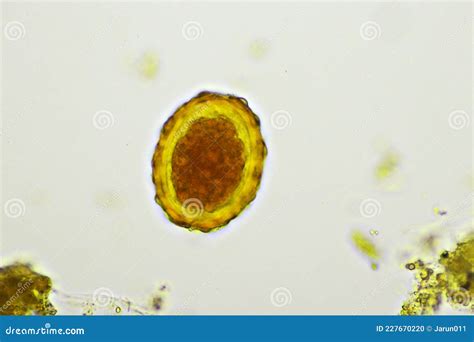 Egg Of Ascaris Lumbricoides In Human Stool Stock Photo Image Of