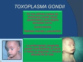 Toxoplasma Gondii Ppt