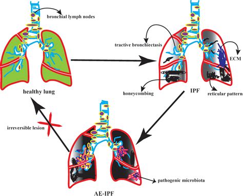 Frontiers Potential Targeted Therapy Based On Deep Insight Into The