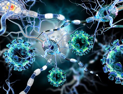 Rasmussen Syndrome - The Defeating Epilepsy Foundation