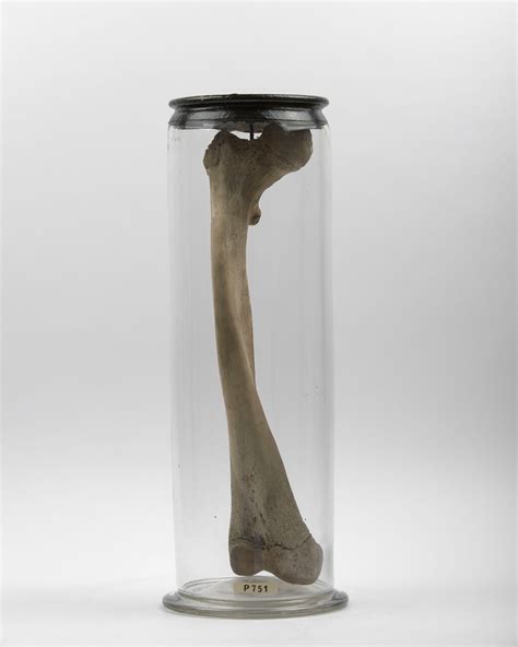 Specimens in Focus 🔍 This is... - Hunterian Museum, London