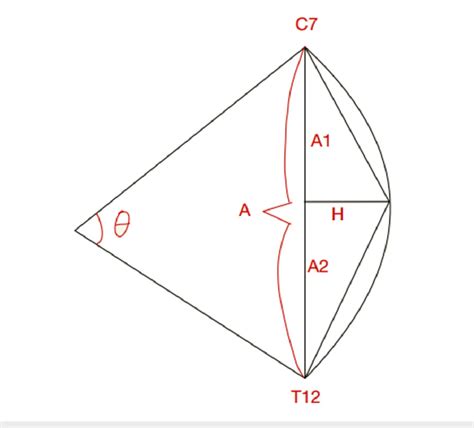 Flexicurve angle (Theta angle, ) is calculated using lines drawn ...