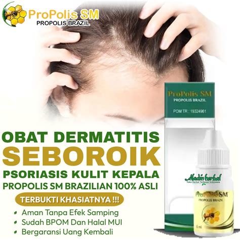 Jual Propolis Sm Original Obat Dermatitis Seboroik Di Apotik Obat