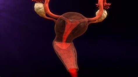 Coágulos De Sangue Menstruação - Causas dos coágulos de sangue na menstruação