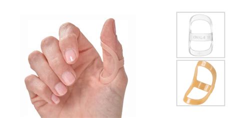 Treating Trigger Thumb With An Oval-8 Finger Splint Updated, 43% OFF