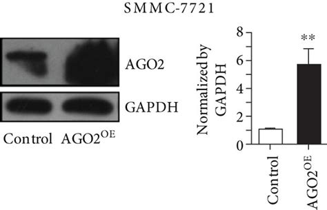 Ago2 Overexpression Promoted Proliferation And Migration Of Smmc 7721