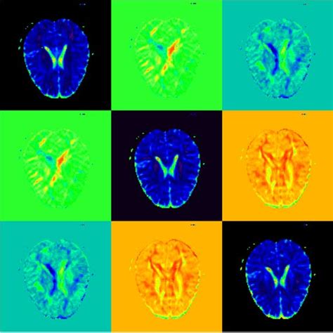 Figure 1 From Parallel Simulation Of Anisotropic Diffusion With Human