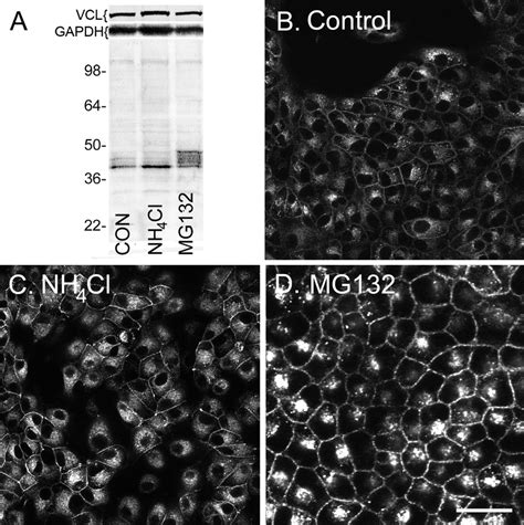 Lysosomal And Proteasomal Inhibitors Similarly Affect Cx Protein