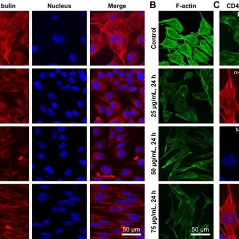 Organization Of The Cytoskeleton In B16 F10 Cells Notes A B