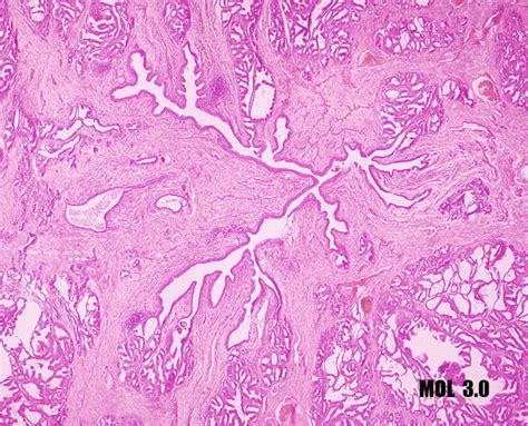 Histología De La Uretra Prostática