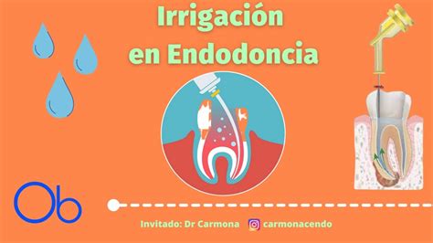 Irrigación en Endodoncia con Dr José Alberto Carmona Corona YouTube