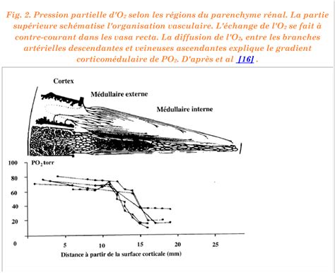 Figure From Insuffisance R Nale Aigu Semantic Scholar