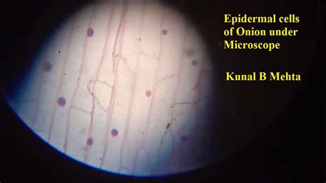 Onion Epidermal Cells Under Microscope