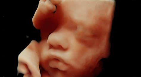 What Is A 4d Ultrasound Scan Importance And How It Works 51 Off