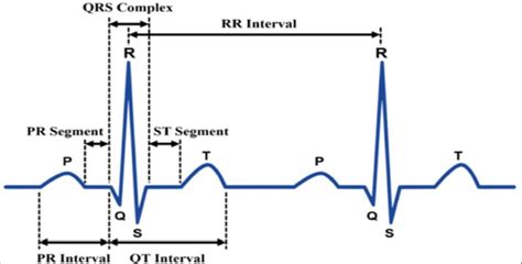 Normal Ecg Signal 12 Download Scientific Diagram