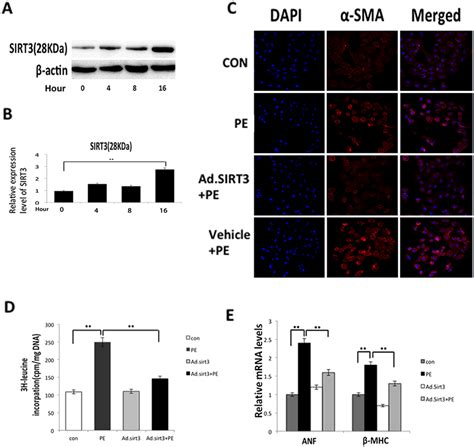 Overexpression Of Sirt3 Blocked The Cardiac Hypertrophic Response In