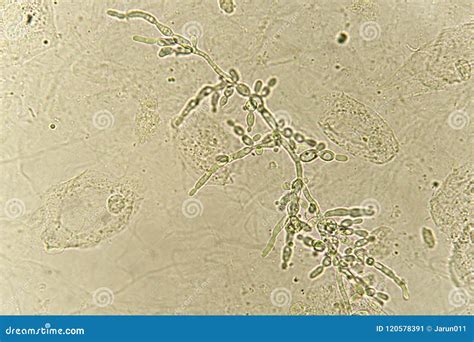 Budding Yeast Cells In Urine