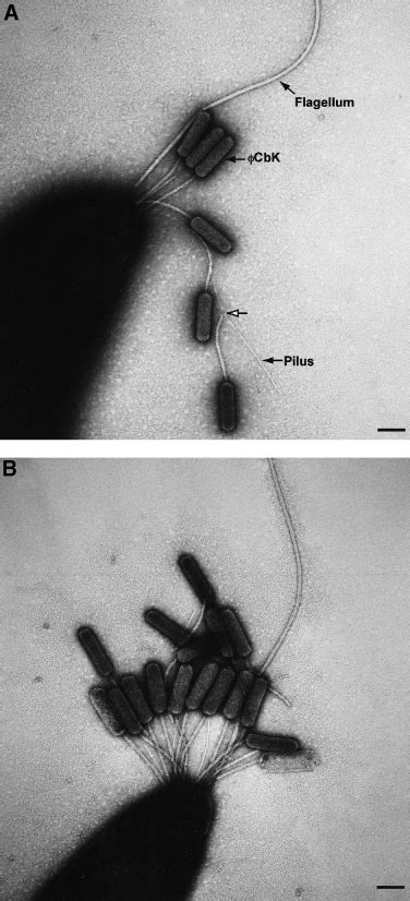 Electron Microscopy Of FCbK Infection Of C Crescentus Swarmer Cells