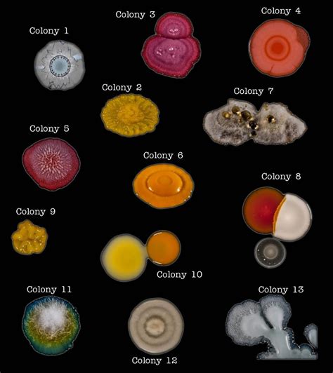 Solved Describe Fully The Colonial Morphology Of The